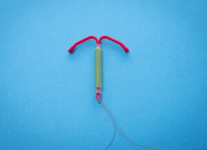 Levonorgestrel- releasing IUD